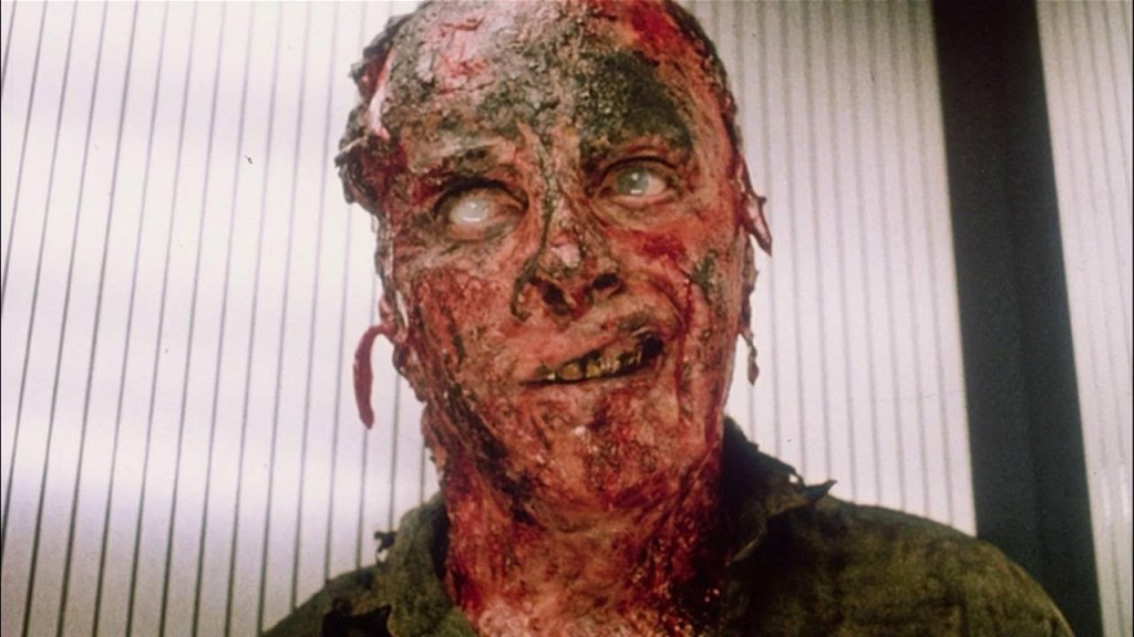 An up-close look at a horrifically burned man, with one milky eye.